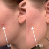 DermaDots™ | Alltid en strålende og sunn hud!