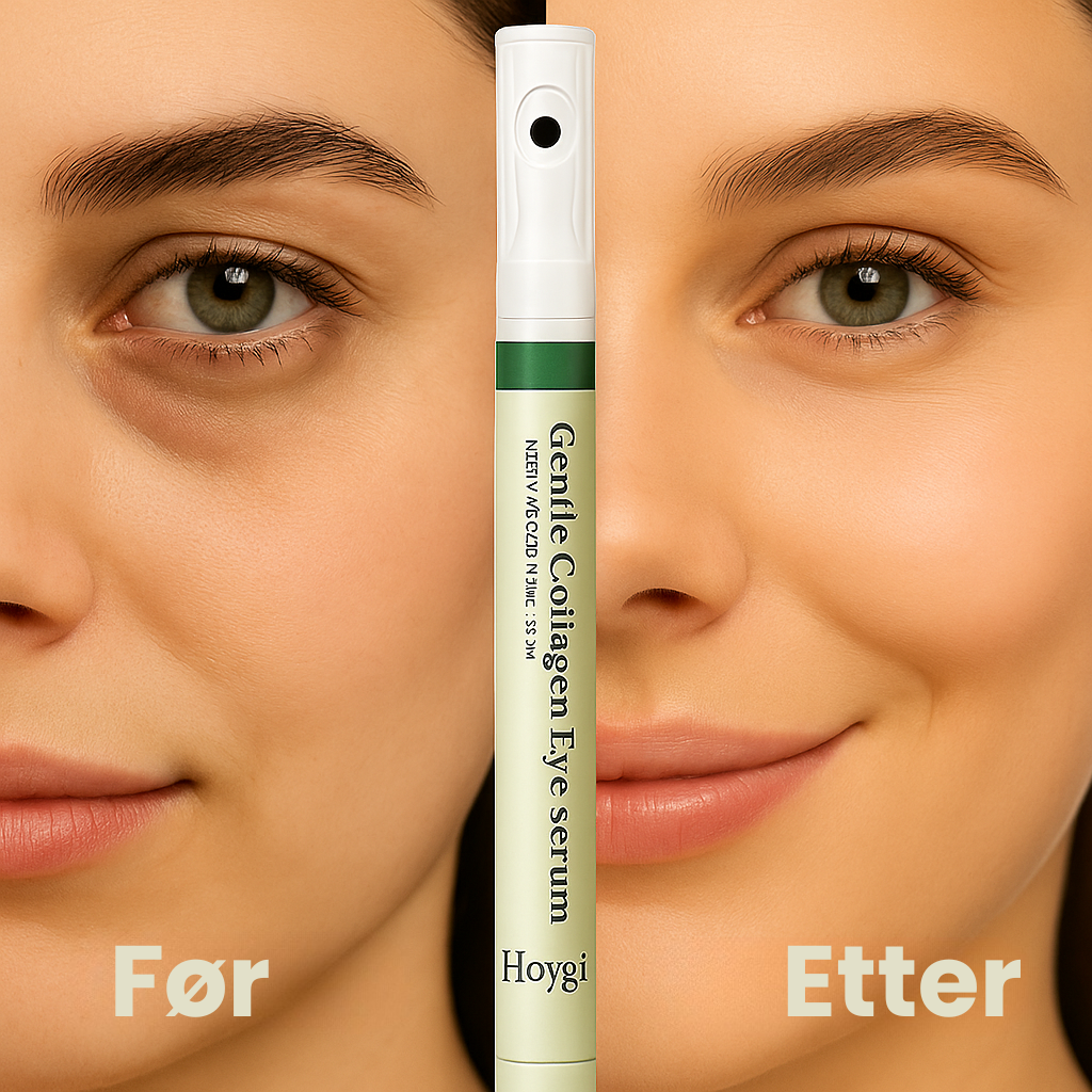 Hoygi™ | For den vakreste huden!