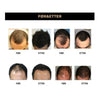 HairFix™ | Ikke flere skallede flekker!